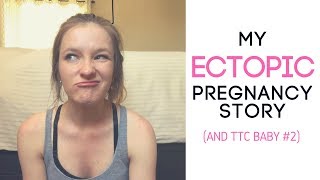 My Ectopic Pregnancy Story