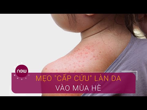 Video: Tình Trạng Da Mèo: Da Khô, Dị ứng Da, Ung Thư Da, Da Ngứa, V.v