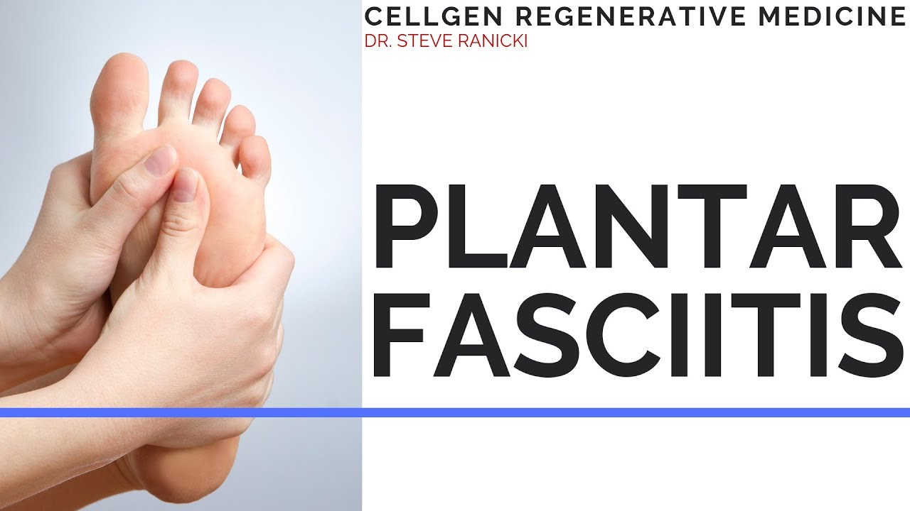 PLANTAR FASCITIS
