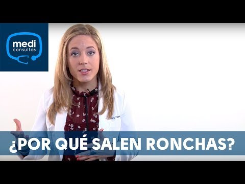 Video: ¿Ha estado brotando urticaria?