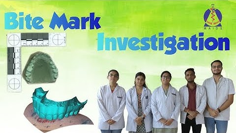 Bite mark investigation