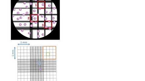 58071 Pre Prac Tutorial hint video - Haemocytometer calculation