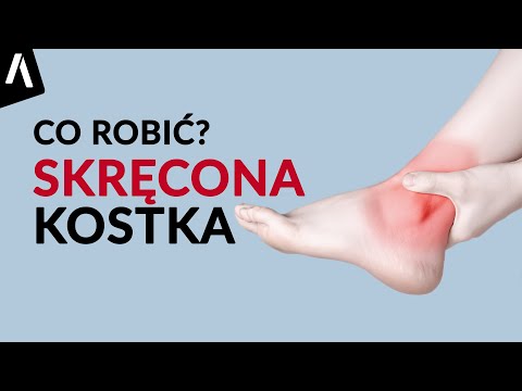 Wideo: Co Robić, Gdy Boli Cię Kostka