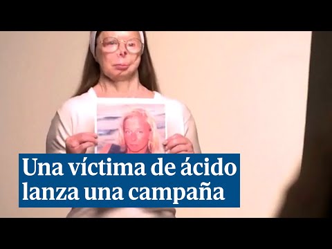 Una víctima de un ataque con ácido lanza una campaña fotográfica