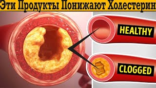 Эти продукты ПОНИЖАЮТ ХОЛЕСТЕРИН! Как очистить артерии без лекарств?!