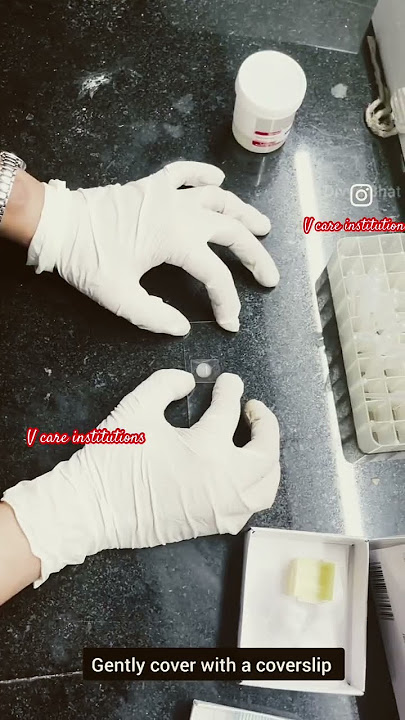 Sperm test | calculations sperm test #pathology #typhidot #biochemistrytest #hematology #bmlt