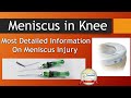 Everything you need to know about Meniscus in Detail (English)