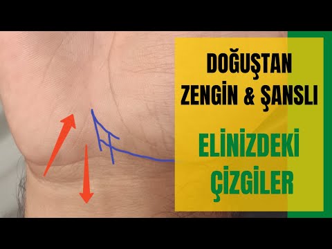 Doğuştan Zengin & Şanslı - Elinizdeki Çizgiler & Semboller