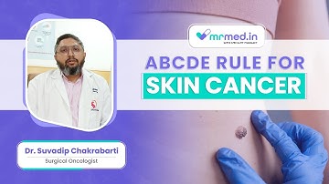 How To Detect Skin Cancer With ABCDE Rule - Dr. Suvadip Chakrabarti I MrMed