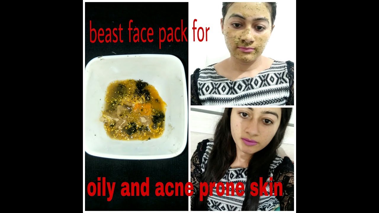 Homemade face pack for oily skin and acne prone skin in hindi,oily skin
