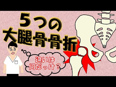 【違いは何？】５つの大腿骨骨折！各病態や合併症を７分で簡単解説♪