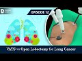 Vats vs open lobectomy for effective lung cancer treatment  drsandeep nayak   dr sreekanth reddy