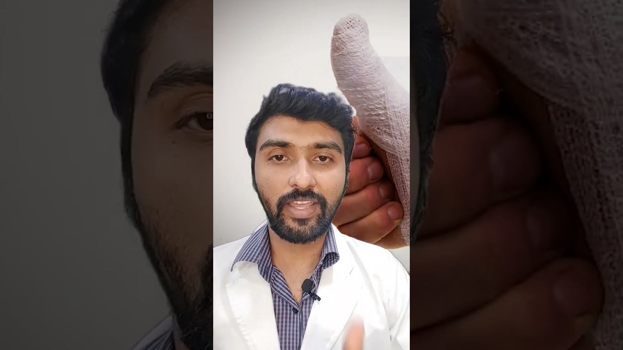 #dentalawareness #chennaidentist #youtubeindia #youtubeshorts #dentalhealth #healtheducation