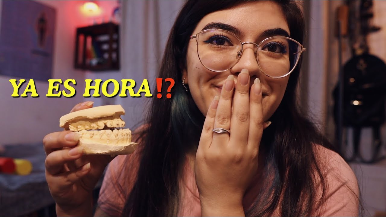 Vlog 1 Me Voy A Operar La Cara Cirug a Ortogn tica Clase III 