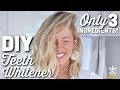 How To Get Whiter Teeth Naturally + DIY Whitening Toothpaste