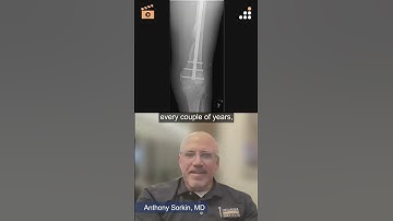 Antegrade vs. Retrograde Nailing Options 2