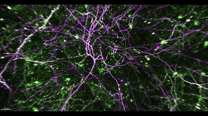 What Learning Looks Like in the Brain