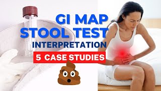 GI MAP Interpretation: Real IBS Patient Stories