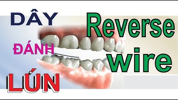 Dây cung ĐÁNH LÚN  - Dây Niti Reverse Super Elastic Titanium Memory