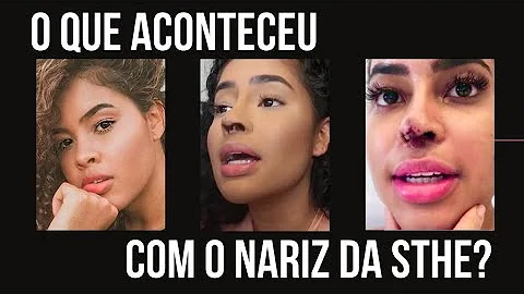 O que aconteceu no nariz de STHE?