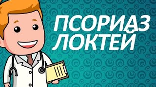 ЛУЧШЕЕ лечение псориаза на локтях. Мази от псориаза ЛУЧШЕЕ лечение псориаза на локтях. Мази от псориаза