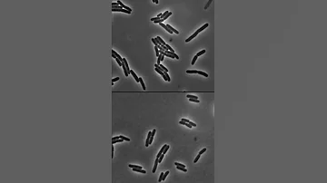 ¿Pueden sobrevivir las bacterias a una olla a presión?