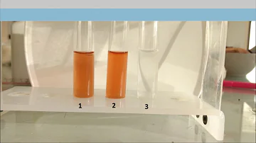 Comment se fait la synthèse de la mélanine ?