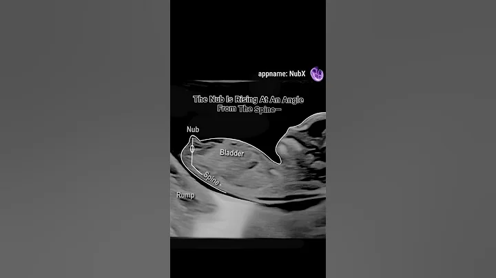 Gender reveal with NubX!