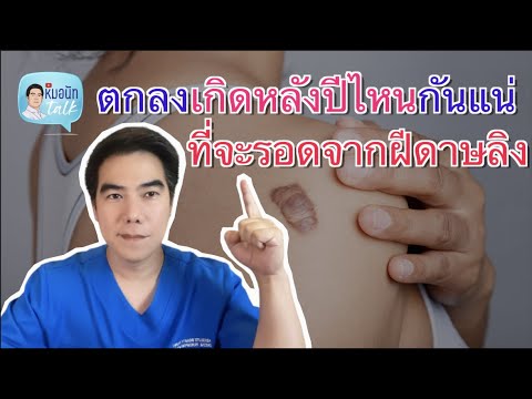 ตกลงเกิดหลังปีไหนกันแน่ ที่จะรอดจากฝีดาษลิง...หมอนัท Talk ep.101