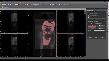 Advanced Tooth Segmentation