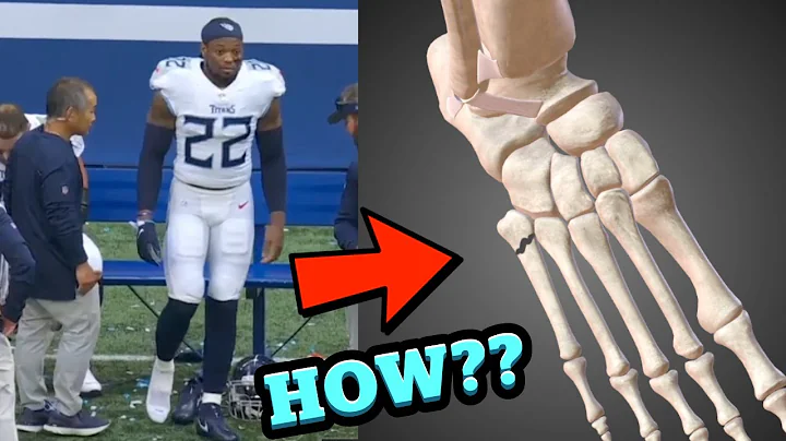 How Derrick Henry Broke His Foot - Doctor Explains...