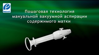 видео: Подготовка и применение мануального вакуум-аспиратора IPas MVA Plus. Процедура взятия биопсии. картинка: Подготовка и применение мануального вакуум-аспиратора IPas MVA Plus. Процедура взятия биопсии.