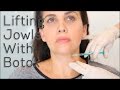 Lifting Jowls With Botox | BLUSH Beverly Hills