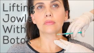 Lifting Jowls With Botox | BLUSH Beverly Hills