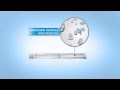 Double action teeth whitening system  how it works