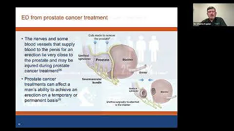 Erectile Dysfunction (ED) Treatment Webinar with Dr. Charles Kaplan