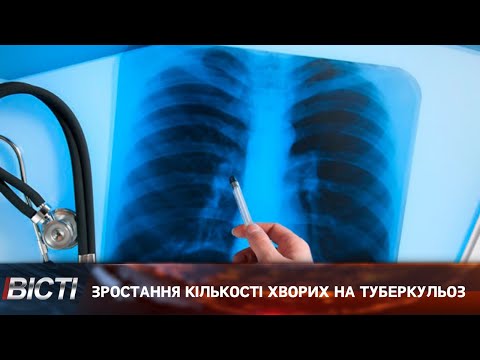 Зросла кількість хворих на туберкульоз