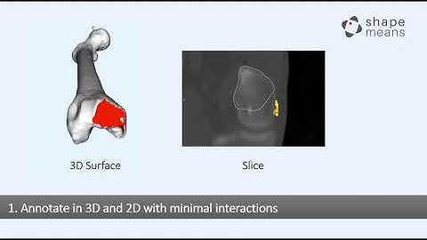 Interactive Segmentation Correction