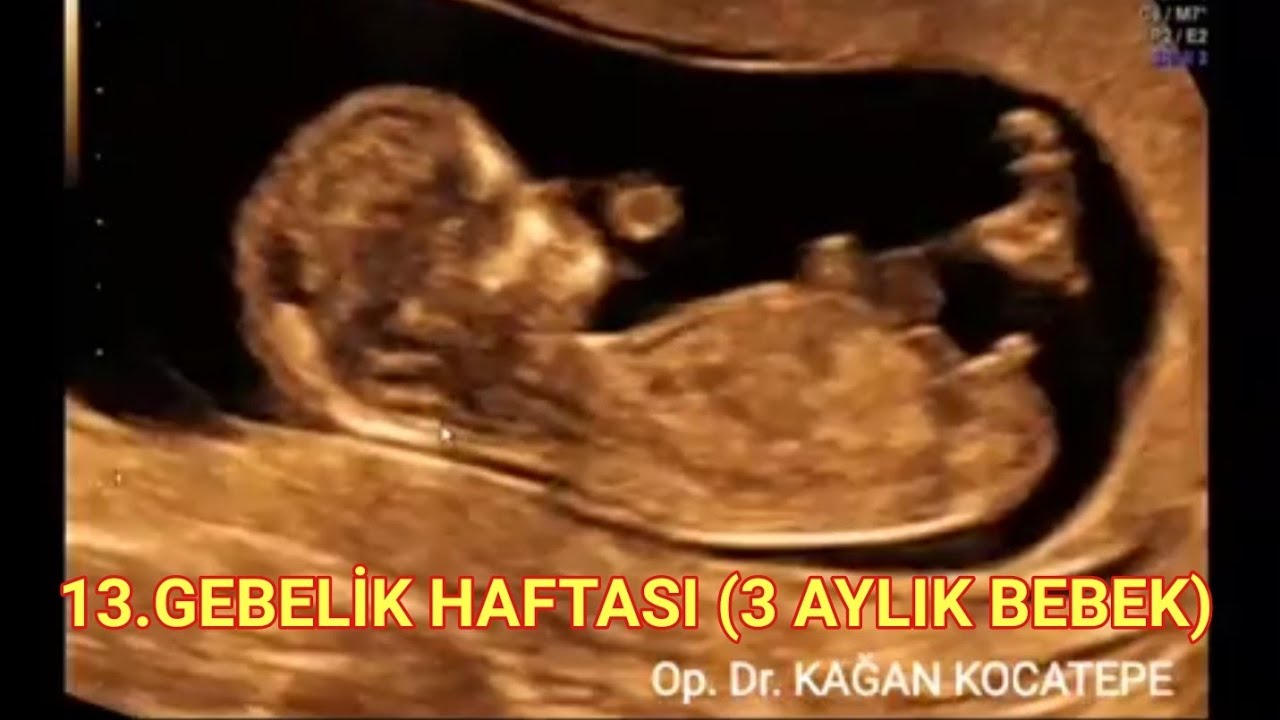 13 gebelik haftasinda yani 3 aylik gebelikte bebek nasil gorunur aciklamali ultrason goruntuleri youtube