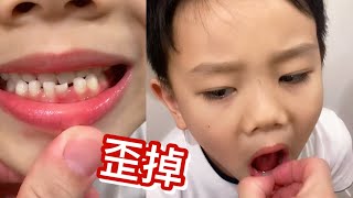 [牙齒快掉了]乳牙歪掉 準備要換牙 ［滾哥滾妹的遊樂世界］