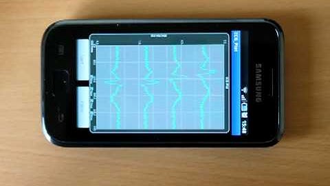ECG ANDROID PLOTTER