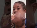 😔💔 Menina do Congo enfrenta um tumor gigante na sua mandíbula 🙌🏽💉 #MeuCorpoMeuDesafio