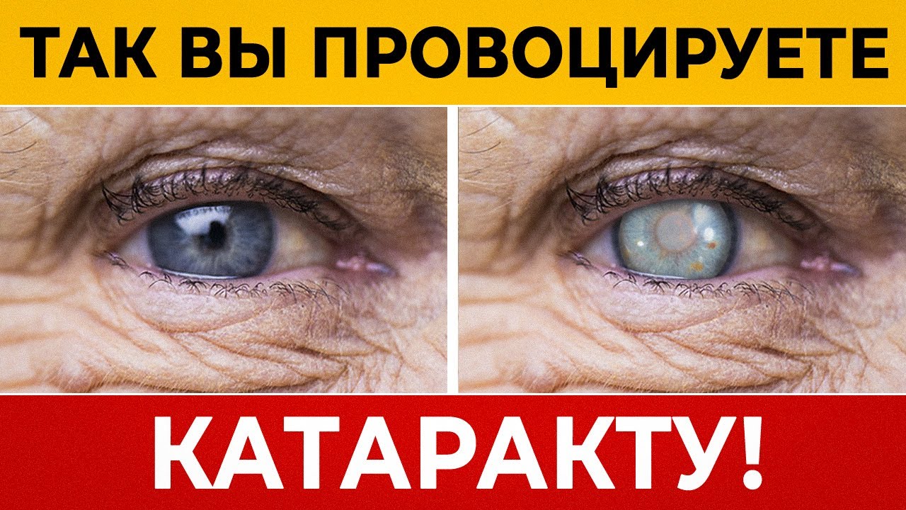 Глаза умирают от ЭТИХ ДЕЙСТВИЙ! Эта глупая ошибка вызывает КАТАРАКТУ ...
