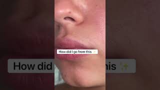 Remove unwanted facial hair with the Flawless Face hair remover unit ✨ screenshot 5