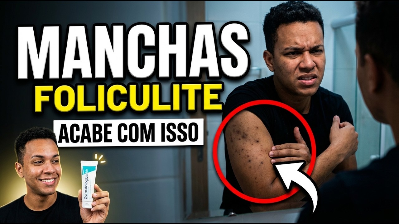 MANCHAS DE FOLICULITE SÃO COISA DO PASSADO [TRANSFORME SUA PELE AGORA!]