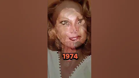 Shocking Transformations! Caitlyn Jenner, Jocelyn Wildenstein & Lyn May Then vs Now