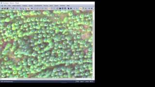 Cara Hitung Pohon Otomatis (Tree Counting) dengan eCognition