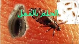 تفسير رؤية القمل في المنام