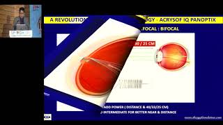 AIOC2019   GP171   Topic   Upload   A revolution in Trifocal Technology  AcrySof IQ PanOptix1     Dr