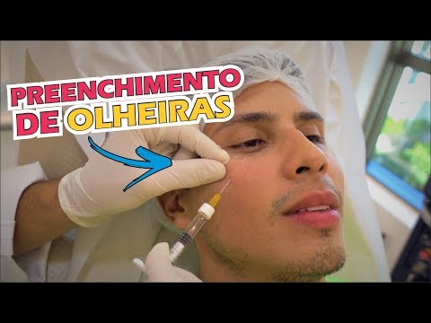 Vídeo: Remoção De Olheiras Sob Os Olhos Para Homens